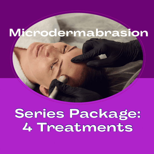 Microdermabrasion (Series Of 4) at Radiant Beauty Collective By Rach in Rockford, IL